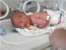 My Preemie Son After Birth