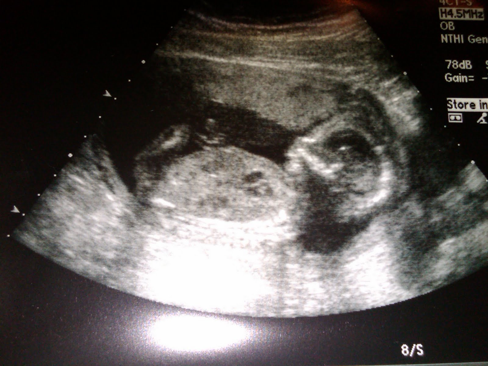 [chris-jordan-ultrasound.jpg]