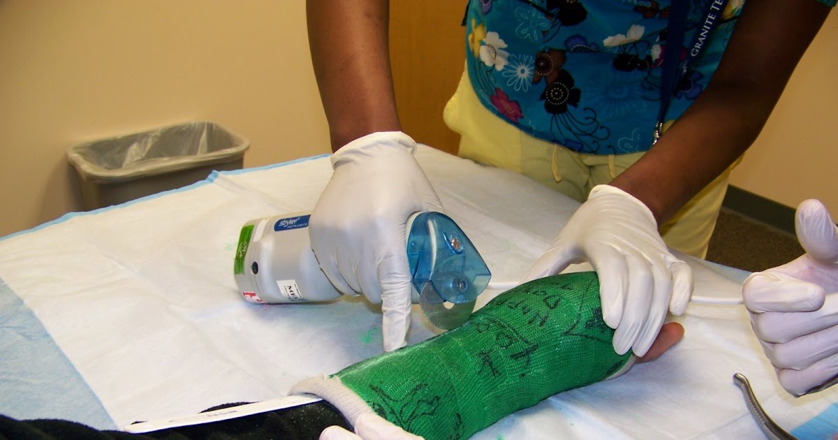 joannerenae Green casts off, Black Cast on & Pin removal