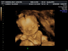 Baby B 3D at 21 weeks