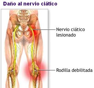 El ungüento a la osteocondrosis los medios públicos