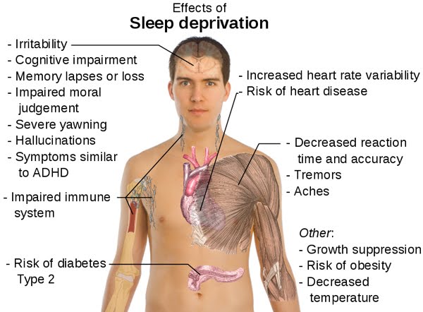 Effects of sleep deprivation