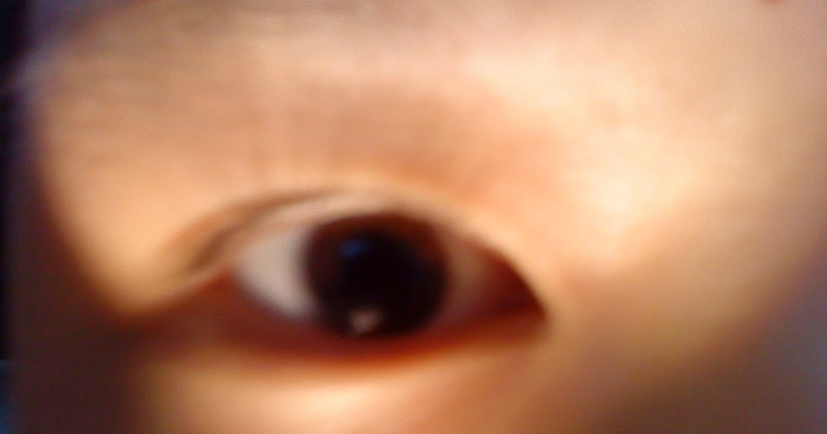 OptometryMore than what meets the eye. About ''PERRLA''