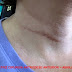 A CIRURGIA