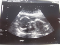 Baby Deines 1-24-08