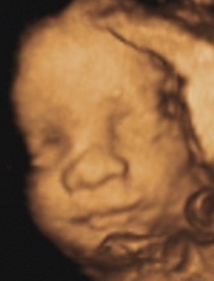 [30wks6.jpg]