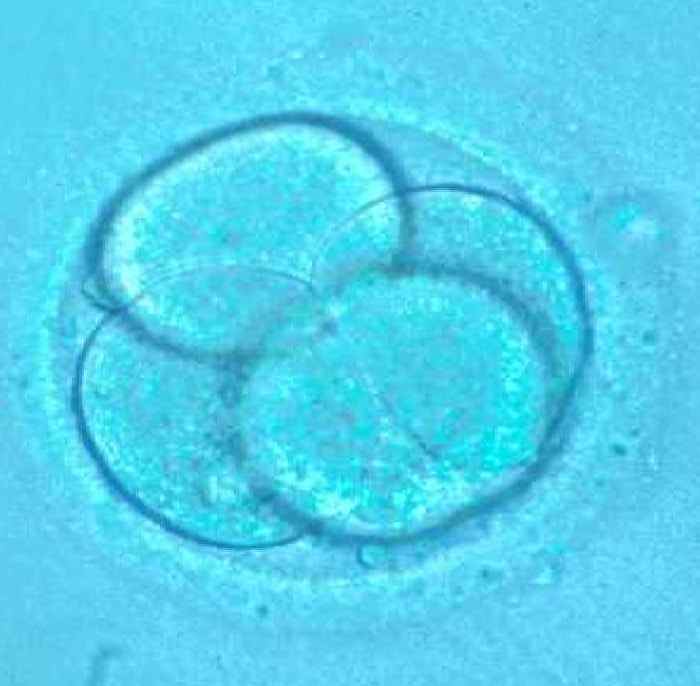 El Factor de transferencia El Factor de transferencia