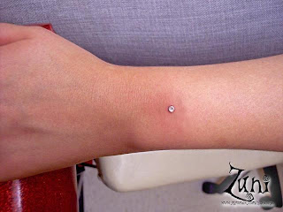 micro dermal anchor