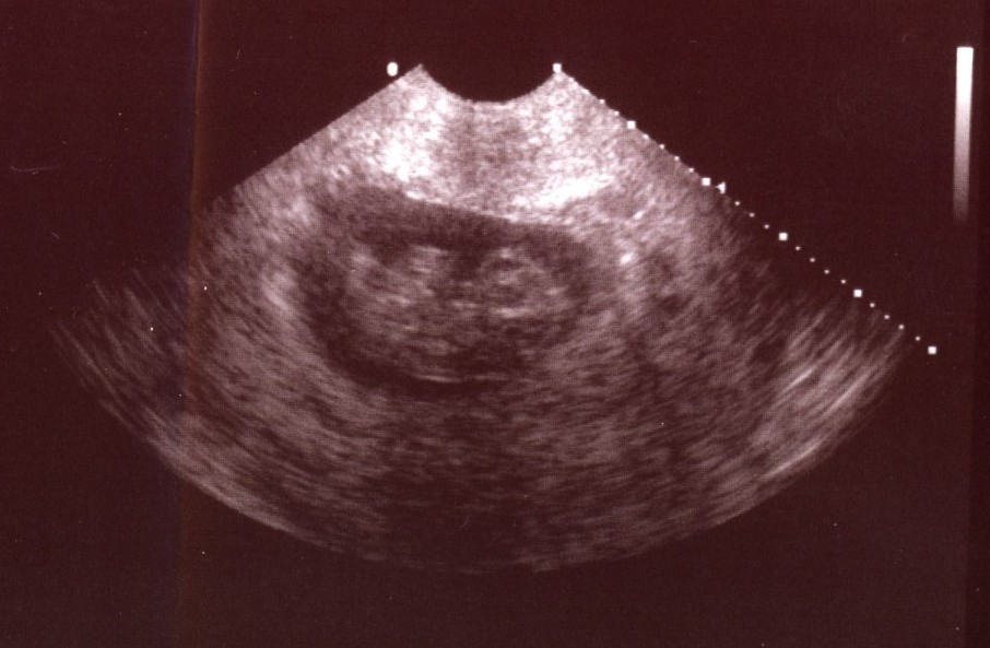 [New+Baby+-+9wks(crop).jpg]