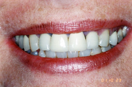 [black+gums.jpg]