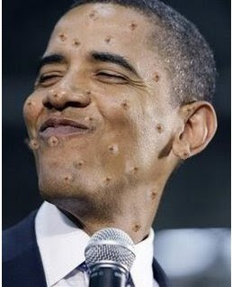 [Image: mole+head+barack+obama.jpg]