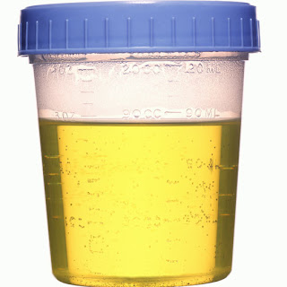urine.jpg