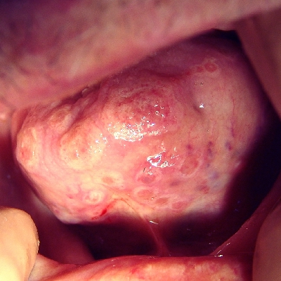 Cropping operation on the penis bridle