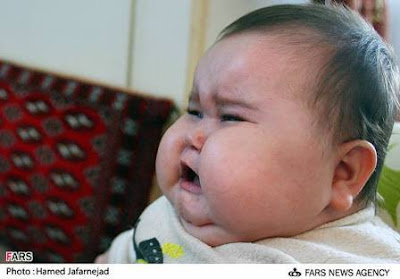 Unbeliveable 20 kg baby born in Tehran,Iran