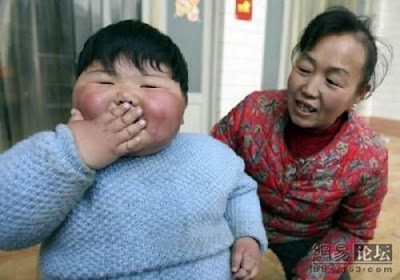 Unbeliveable Chinese Girl Weighs 41.3 Kgs Pictures