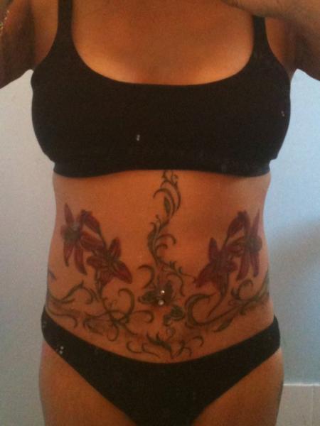tummy tuck scars weigh the pros and cons blog tattoo tummy tuck scars weigh the pros and cons blog tattoo