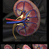 MENGENAL DETAIL GINJAL KITA thumbnail