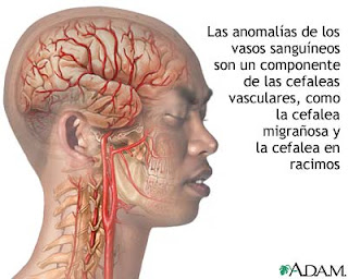 Que ejercicios no es posible hacer con la hernia sheynogo del departamento