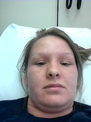 rown recluse spider bite brown recluse spider bite treatment. rown recluse spider bite