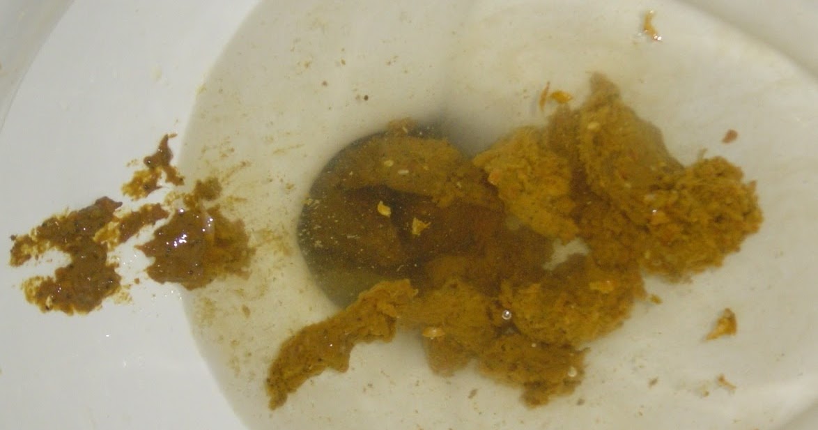 The Poop Log A Sick Sickness Stringy Poo