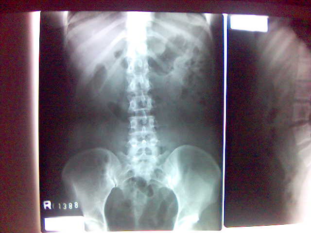 [backbone1]