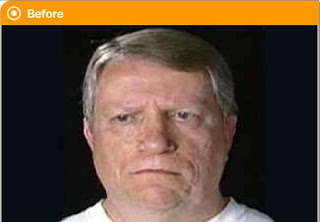 Face Transformation, Life Transformation - Their Life Change Seen On www.coolpicturegallery.us Face Transformation, Life Transformation - Their Life Change Seen On www.coolpicturegallery.us