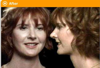 Face Transformation, Life Transformation - Their Life Change Seen On www.coolpicturegallery.us Face Transformation, Life Transformation - Their Life Change Seen On www.coolpicturegallery.us
