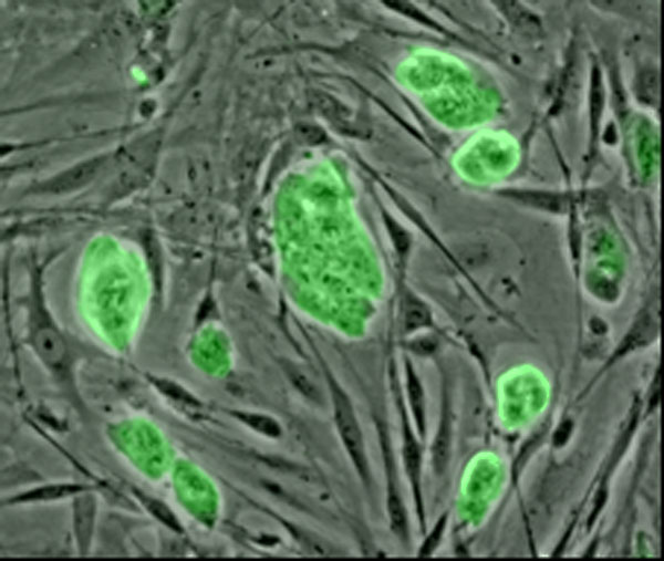 [Mouse_embryonic_stem_cells.jpg]