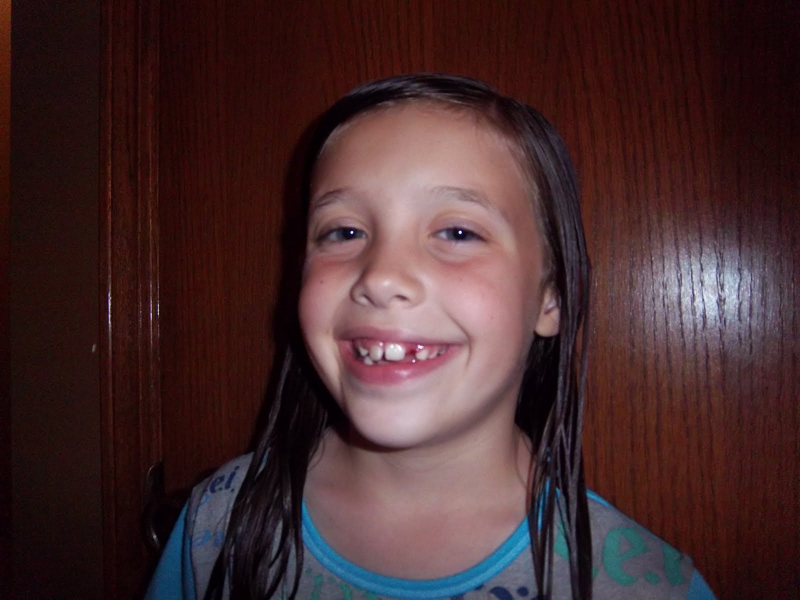 Turner Times! Tooth 8 GONE!