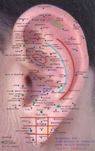 Auriculoterapia