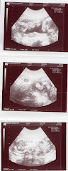 Baby at 17 weeks