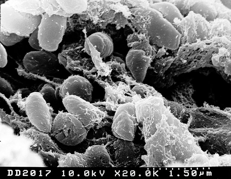 external image 773px-Yersinia_pestis.jpg