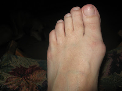 Funny Looking Feet