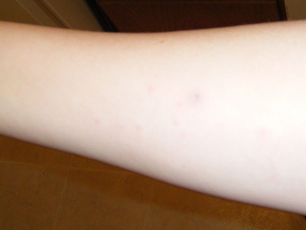 Momma Jorje Attachment Parenting a Child with Lice Part I