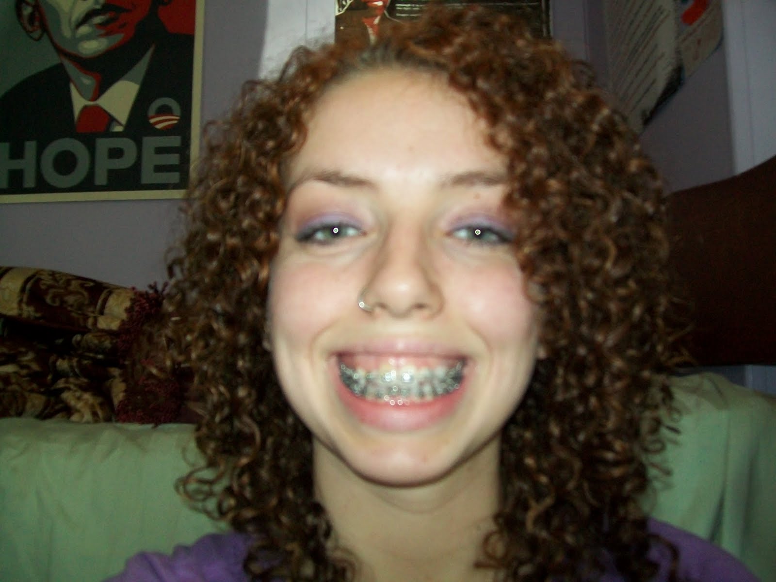 Braces at twenty April 2010