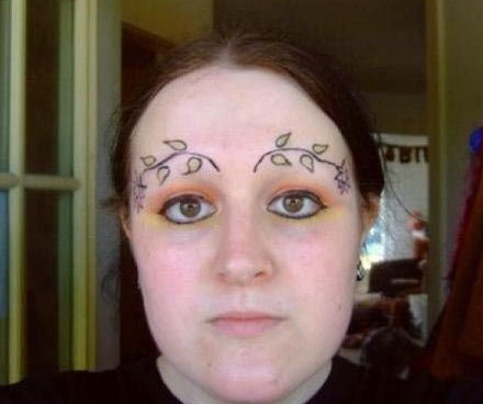 Removing A Tattoo Removing A Tattoo