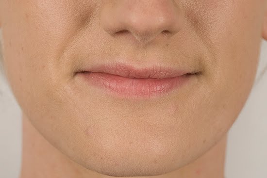 [LauraBeforeCloseUpFront-2.jpg]