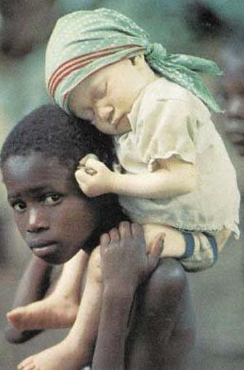 Black Albino Kid