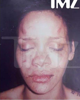 rihanna beaten pictures. rihanna beaten up face.