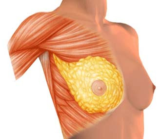 breast augmentation La Jolla
