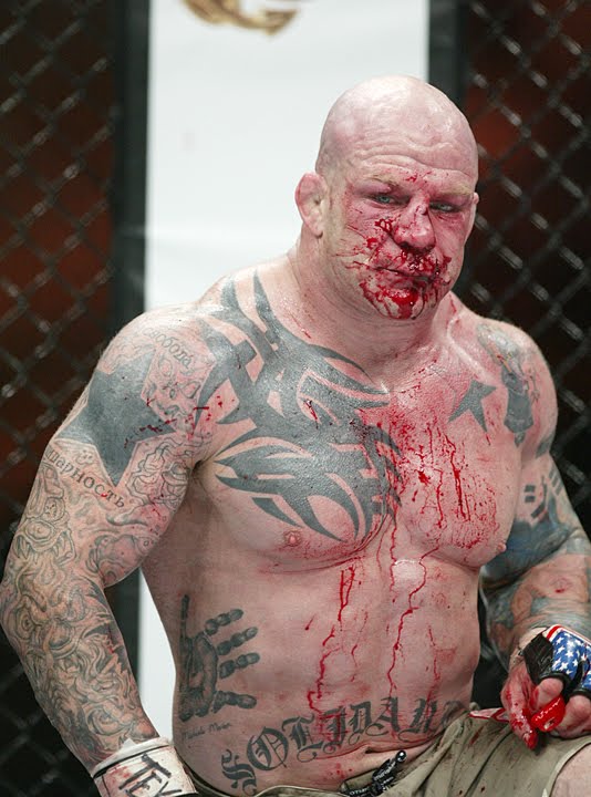 [Monson_Hurt.JPG]
