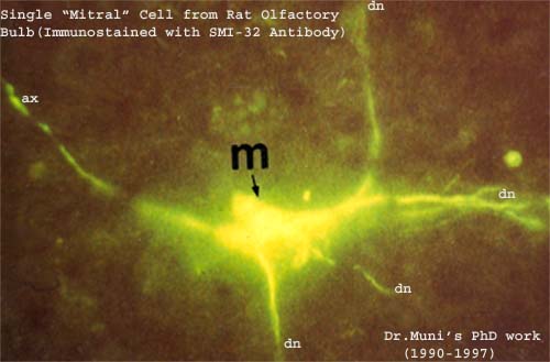 Intraoperative NeuroMonitoring