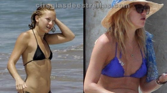 Apologise, Kate hudson breast augmentation Kate hudson breast augmentation not
