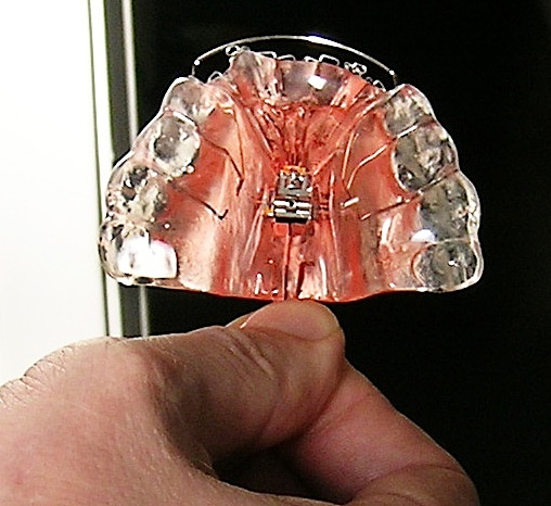 Epigenetic Orthodontics