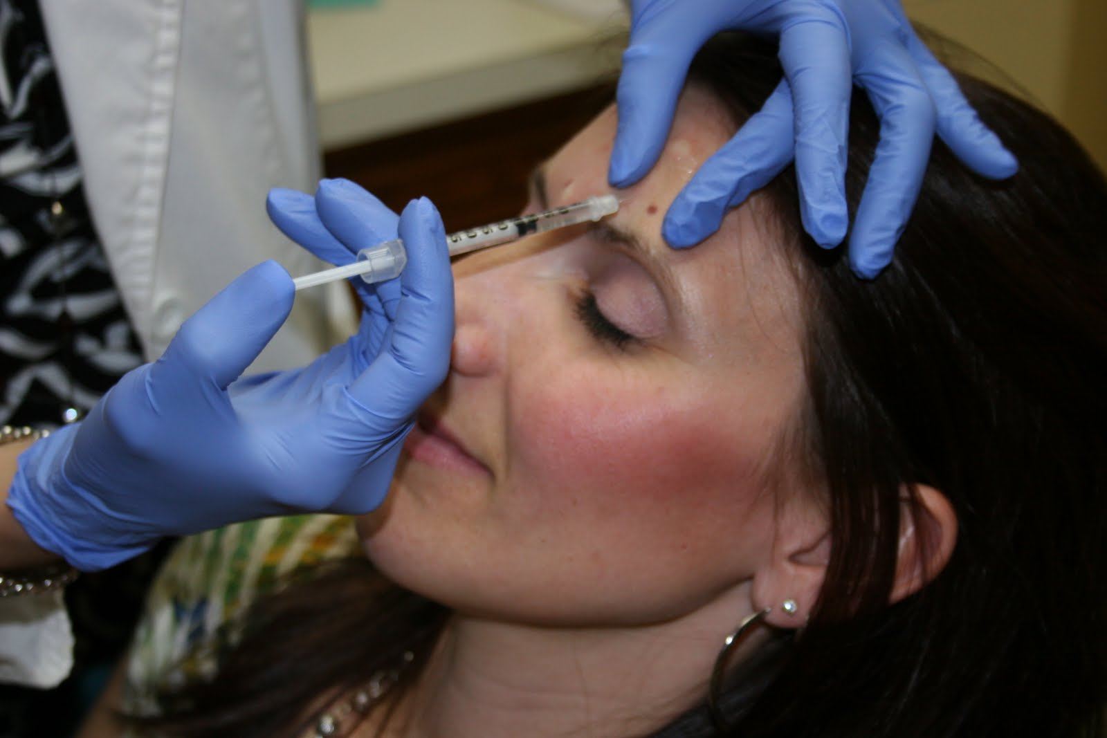 Botox Blunders