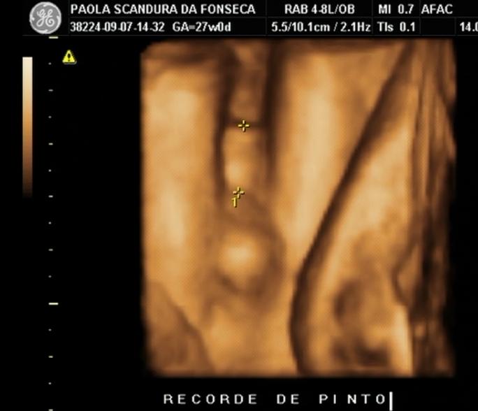 [Recorde+de+pinto.jpg]