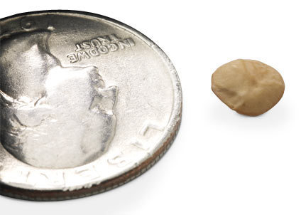 [lentil+bean.gif]