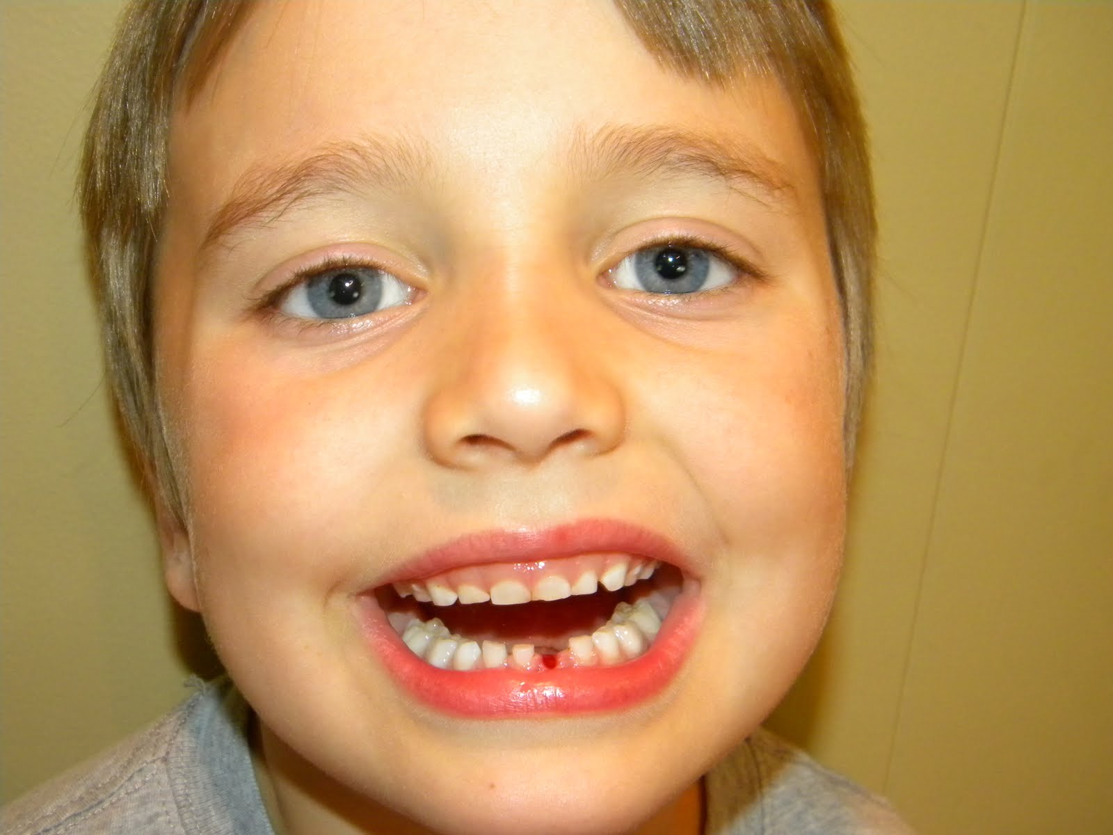 my blue eyed boys Teeth