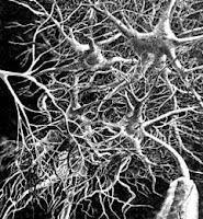 l'arme du pauvre neurones