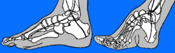 [250px-FootBindingRxSchema2.gif]